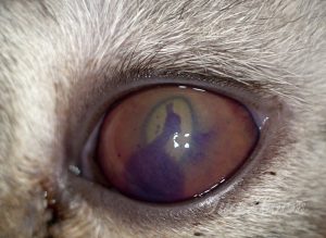 Осложнения на глаза при неправильно поставленном диагнозе и не адекватном лечении